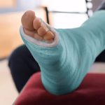 علائمی که نشان می‌دهد پس از جراحی مچ پا باید به پزشک مراجعه کنید