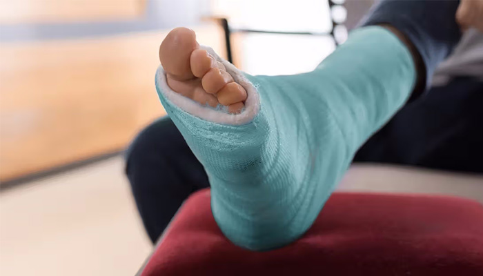 علائمی که نشان می‌دهد پس از جراحی مچ پا باید به پزشک مراجعه کنید